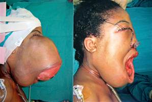 [img width=298 height=199 cacheid=00037e94000872a07fcdb81e1a01b41f9e]http://msnbcmedia.msn.com/j/msnbc/Components/Photos/051222/051222_tumor_hmed_330a.standard.jpg[/img]