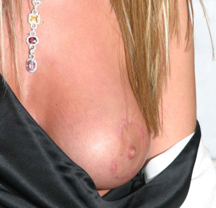 [img cacheid=00078d4a00148da5aac07d681a0073f5e4]http://www.sexapedia.com/Tara/tara9.jpg[/img]