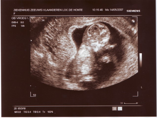 [img width=639 height=481 cacheid=0008a3fc00182b10fdd7d2c81e0001d31e]https://album.partyflock.nl/10550835.jpg[/img]