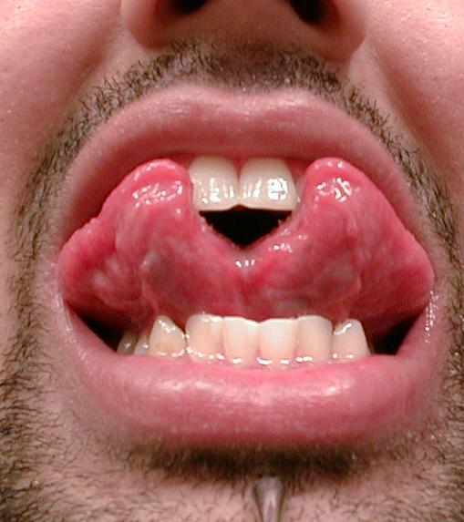 [img width=100 height=113 cacheid=0008e490001901fb46f23f6f1a00b973e1]http://www.ishiboo.com/~nirva/Play/other/cp/tongue.jpg[/img]