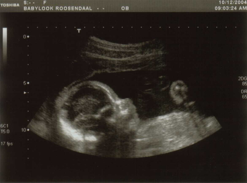 [img width=644 height=477 cacheid=000cb5110024952d7d205d2c1a018239cf]http://www.family-oosten.com/news/images/echo/echo_07.jpg[/img]