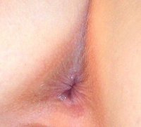 [img width=200 height=181 cacheid=000d3d03001b64bc875c92311a01b48d05]http://content.answers.com/main/content/wp/en-commons/thumb/f/fd/200px-Human_female_anus.jpeg[/img]