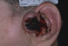 [img width=220 height=148 cacheid=0011dae8002f6ac8193d329a1a02c6e1c9]http://courses.washington.edu/hubio567/lang/odlnd045.gif[/img]