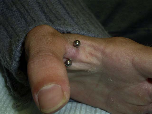 [img cacheid=0012fa4c0002a33fa2befd031a002b984b]http://www.bodycreation.nl/graphics/piercings/RIMG0281.JPG[/img]