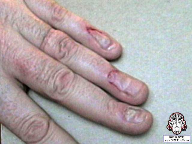 [img cacheid=0012fdf5000d403f6d45b8541a0030ddb9]http://www.bme.freeq.com/service/samples/surghigh/fingernails.jpg[/img]