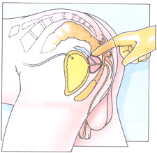 [img width=225 height=219 cacheid=001372a20005f81fd65b59b61b00336f6a]http://www.androsmannenkliniek.nl/Images/RectaalPlaatje.gif[/img]